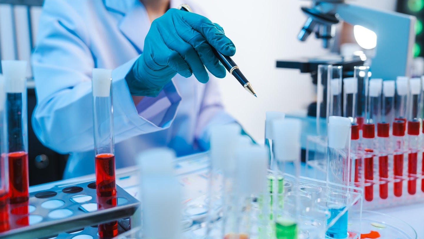 China’s NMPA approves Akeso’s gumokimab for plaque psoriasis