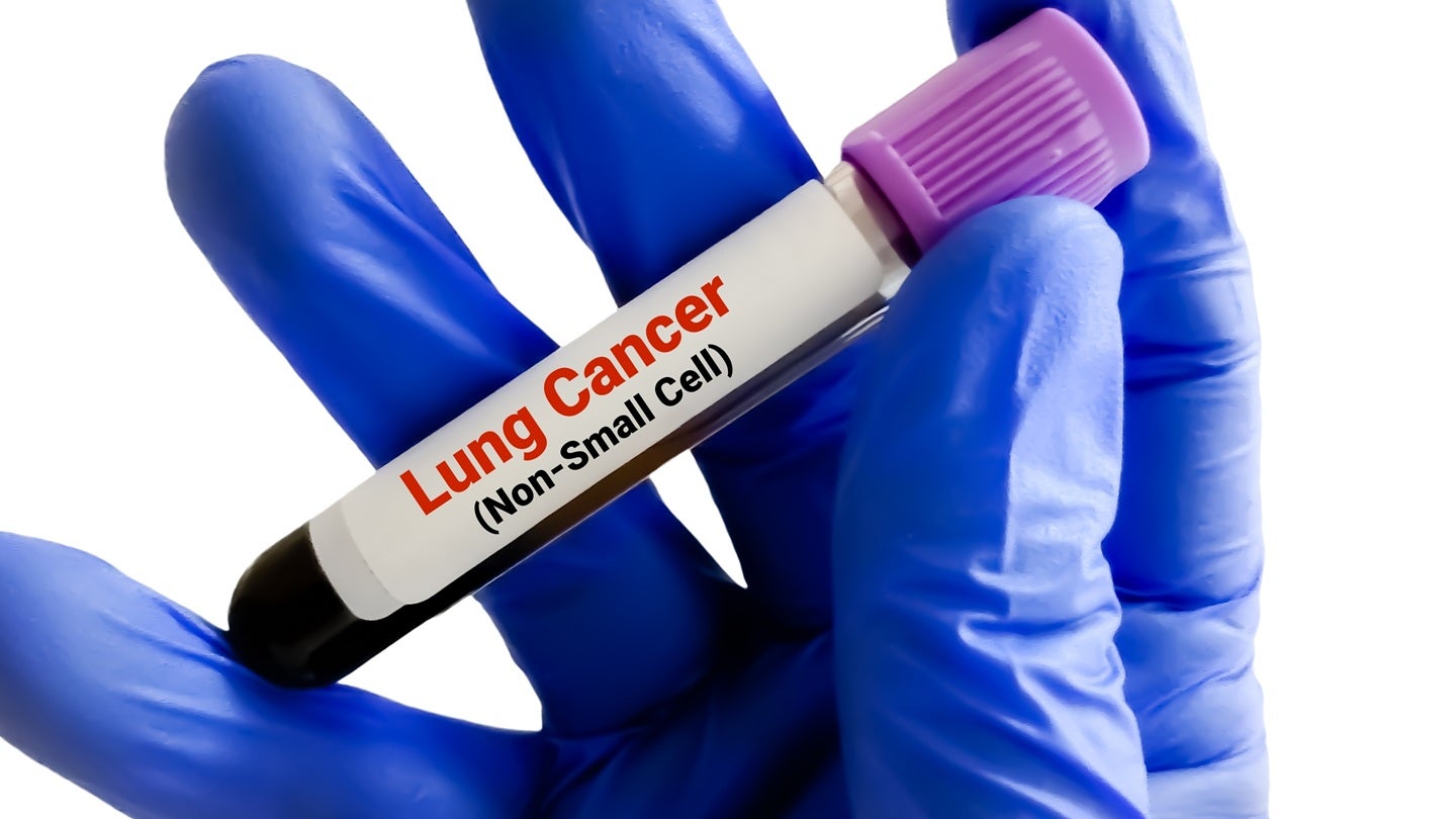 Akeso secures China NMPA authorisation for ivonescimab combo