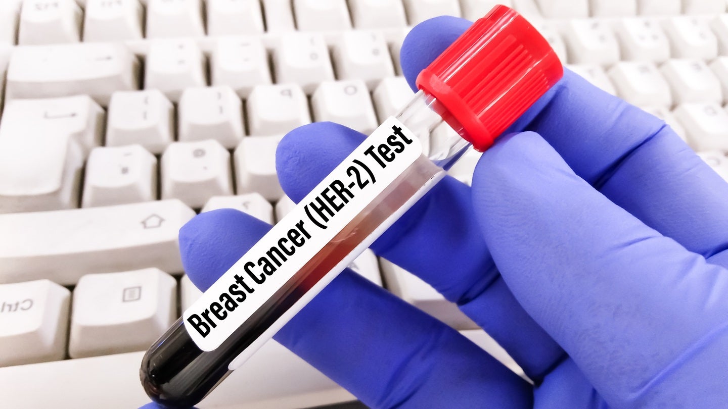 Jazz secures FDA approval for Ziihera in advanced HER2+ GEA
