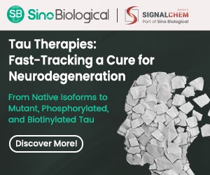 Sino Biological Launches Precisely Characterised Full-Length p-Tau217 Protein to Advance Next-Generation Alzheimer’s Biomarker Assay Development-feature-image
