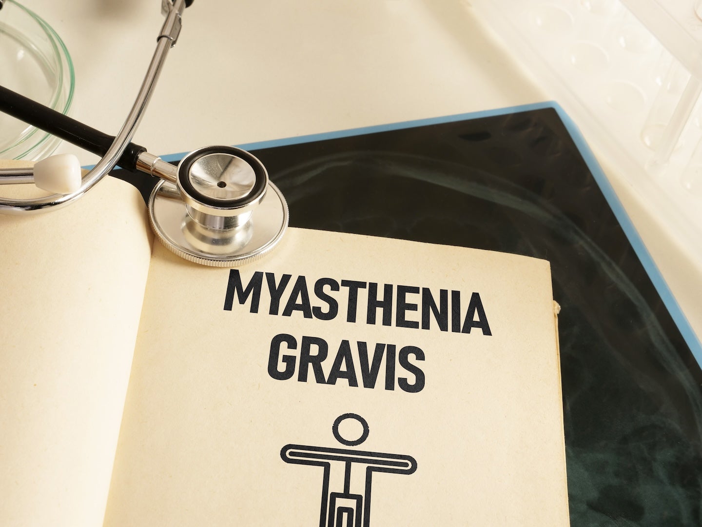 Myasthenia gravis market to reach $13.0bn across 7MM by 2034 - Pharmaceutical Technology