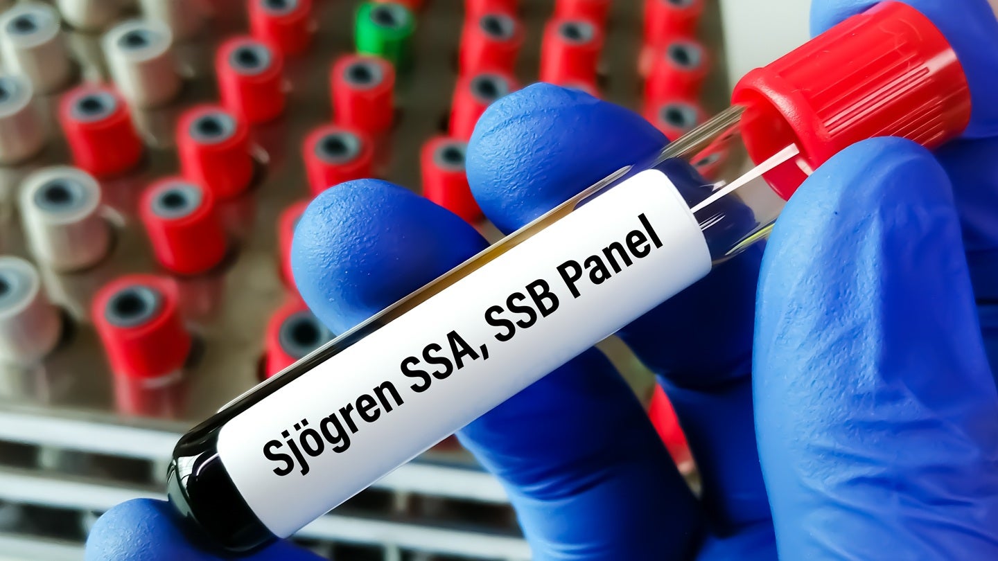 FDA approves Cosette’s Evoxac oral solution for Sjögren’s disease